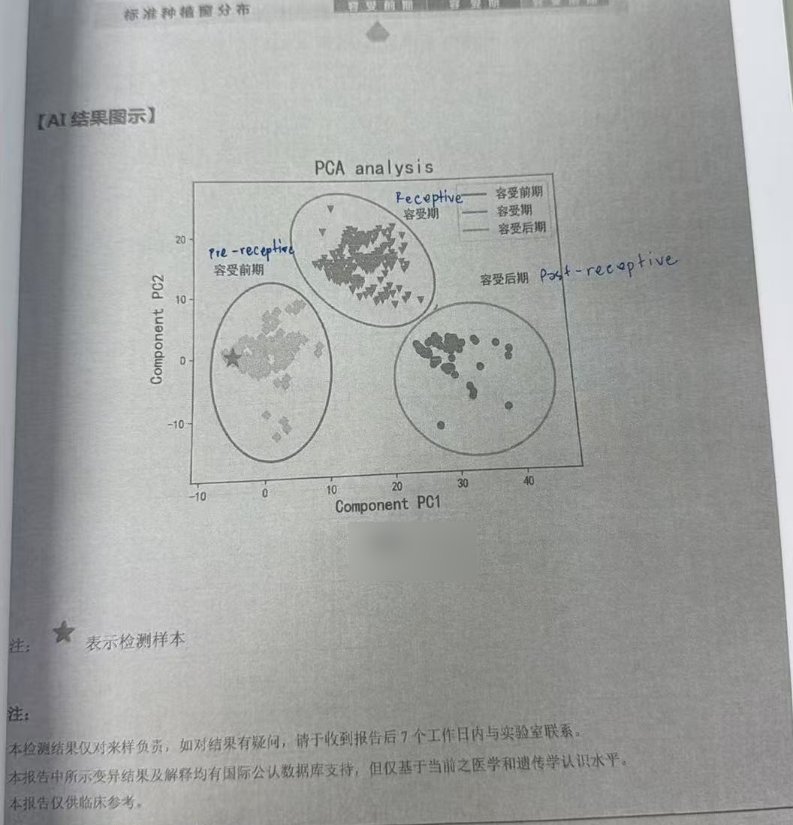 多囊 + 反复移植失败:ERA 定位种植窗,二次移植成功着床