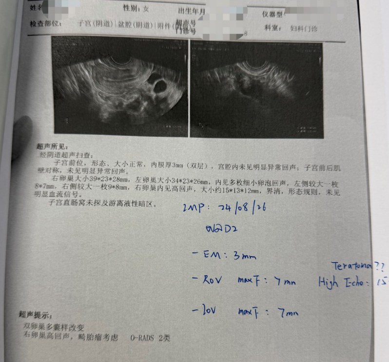 多囊 + 反复移植失败:ERA 定位种植窗,二次移植成功着床