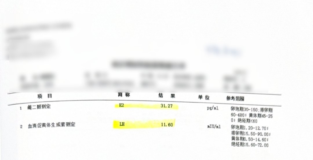 33 岁卵泡发育不同步:温和刺激二次促排,3 颗卵全部成囊,PGT-A 后移植成功