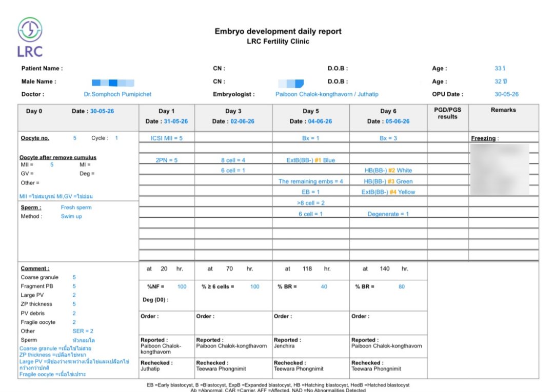 33 岁卵巢早衰,AMH 仅 0.2,伴盆腔粘连:温和刺激 5 颗卵养成 4 颗囊胚