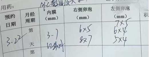 33 岁卵巢早衰 + 男方精子活力仅 1%:PICSI 选精,4 颗受精卵全部成囊
