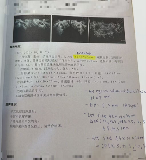 38 岁高龄合并卵泡发育不同步:取卵 11 颗、成熟 8 颗,最终 4 枚健康囊胚