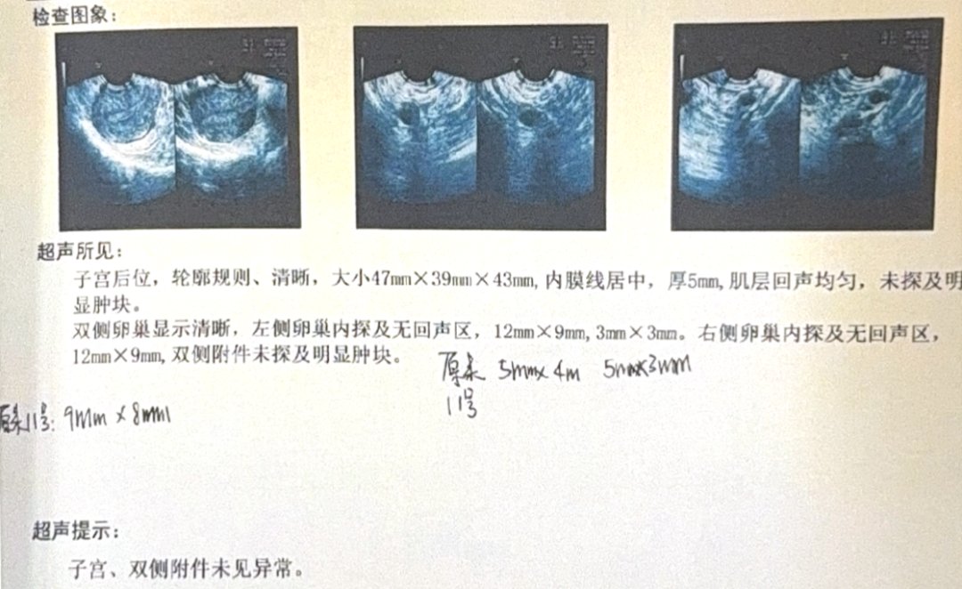 40 岁高龄试管实录:基础卵泡仅 2 颗,温和刺激促排,取卵 4 颗、成囊 1 颗