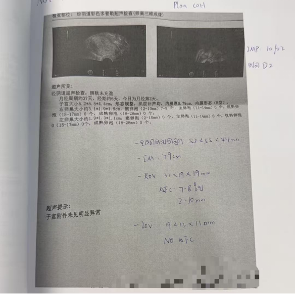 40 岁卵泡不均 + 47 岁精子双低:4 颗受精胚胎全部成囊,过筛 2 枚