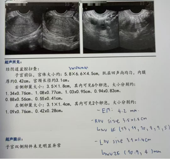 40 岁卵泡不均 + 47 岁精子双低:4 颗受精胚胎全部成囊,过筛 2 枚