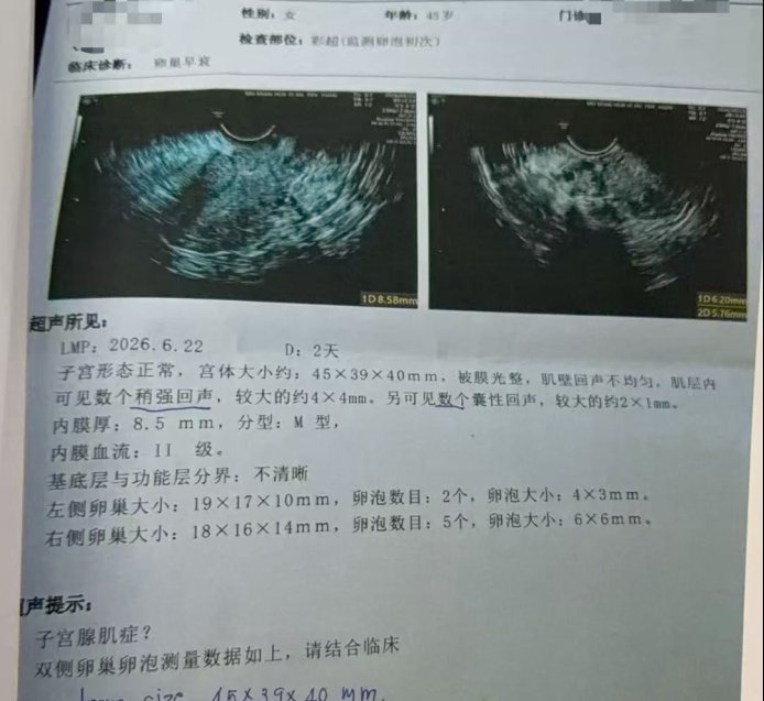45 岁 AMH 0.2,4 颗卵养成 3 枚囊胚:低储备患者如何把每颗卵用到极致