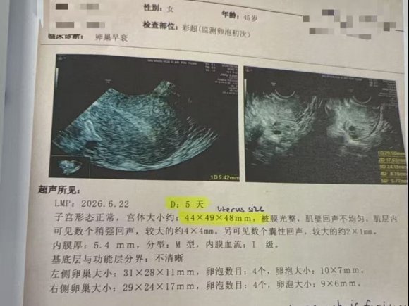 45 岁 AMH 0.2,4 颗卵养成 3 枚囊胚:低储备患者如何把每颗卵用到极致