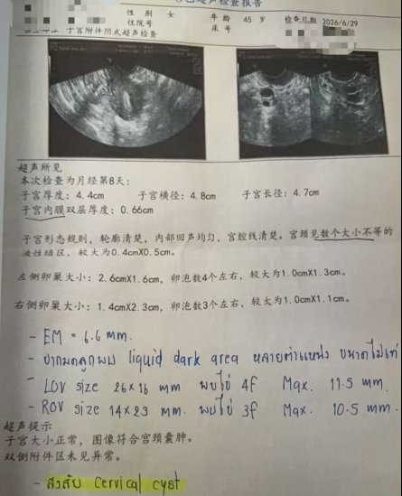 45 岁 AMH 0.2,4 颗卵养成 3 枚囊胚:低储备患者如何把每颗卵用到极致