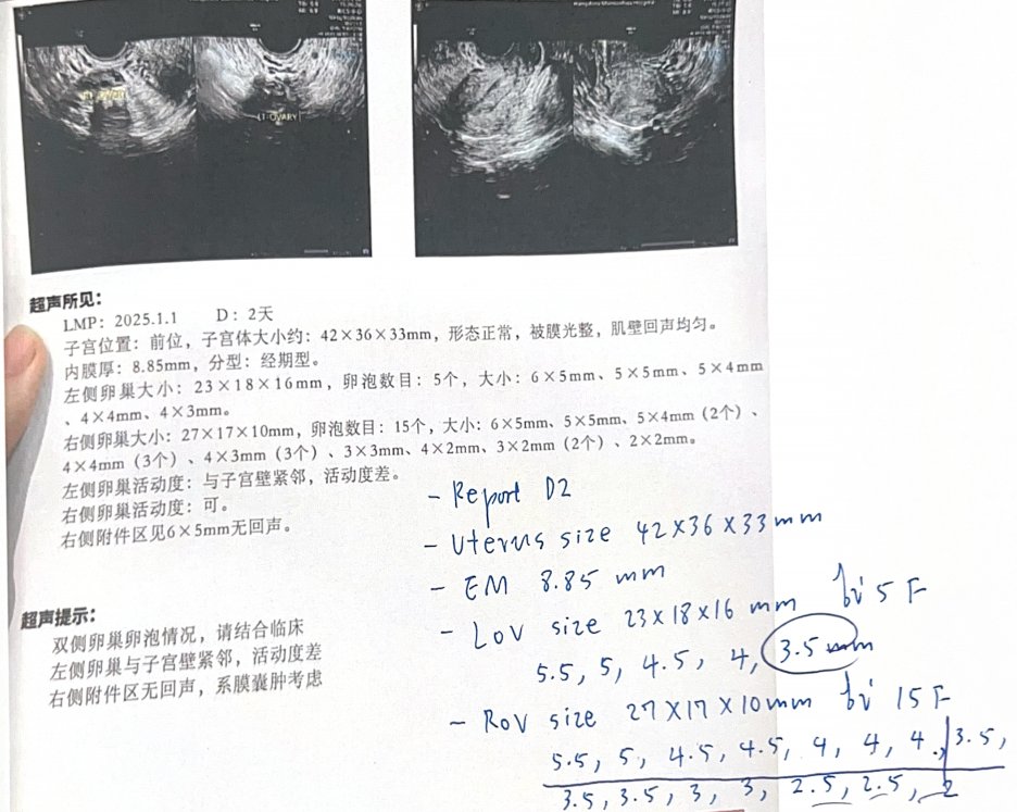 25 岁也做三代试管?阻断家族遗传性耳聋:8 枚囊胚筛出 2 枚健康胚胎