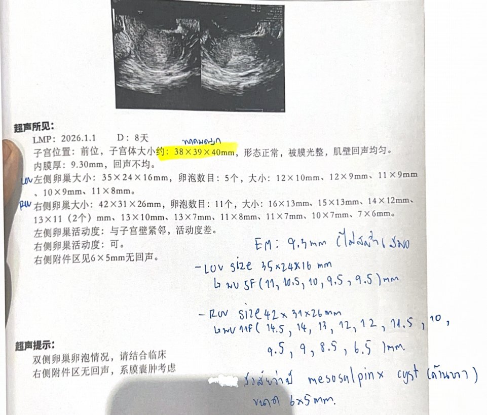 25 岁也做三代试管?阻断家族遗传性耳聋:8 枚囊胚筛出 2 枚健康胚胎