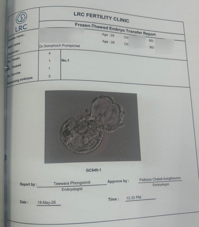 28 岁染色体平衡易位赴泰试管:PGT-SR + MaReCs 一次促排获 2 枚健康胚胎,移植成功好孕