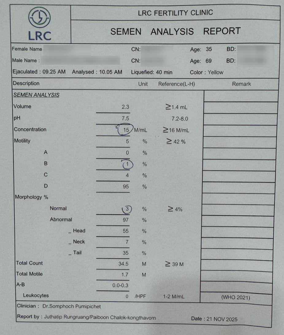 男方 69 岁重度弱精(活力仅 1%):DGC 精子优化 + ICSI,6 周见胎心