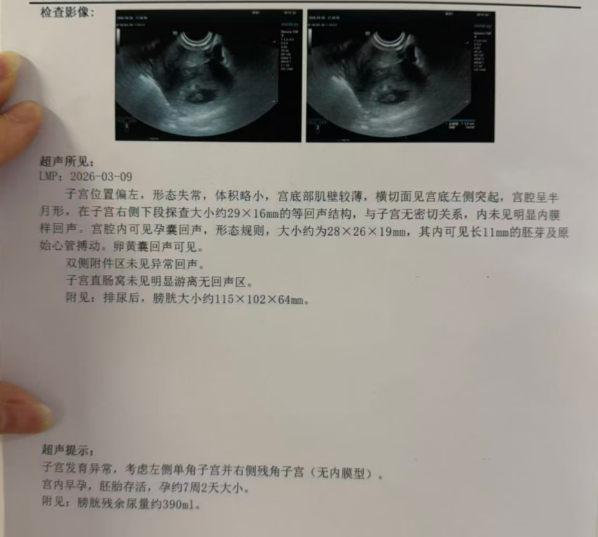 男方 69 岁重度弱精(活力仅 1%):DGC 精子优化 + ICSI,6 周见胎心