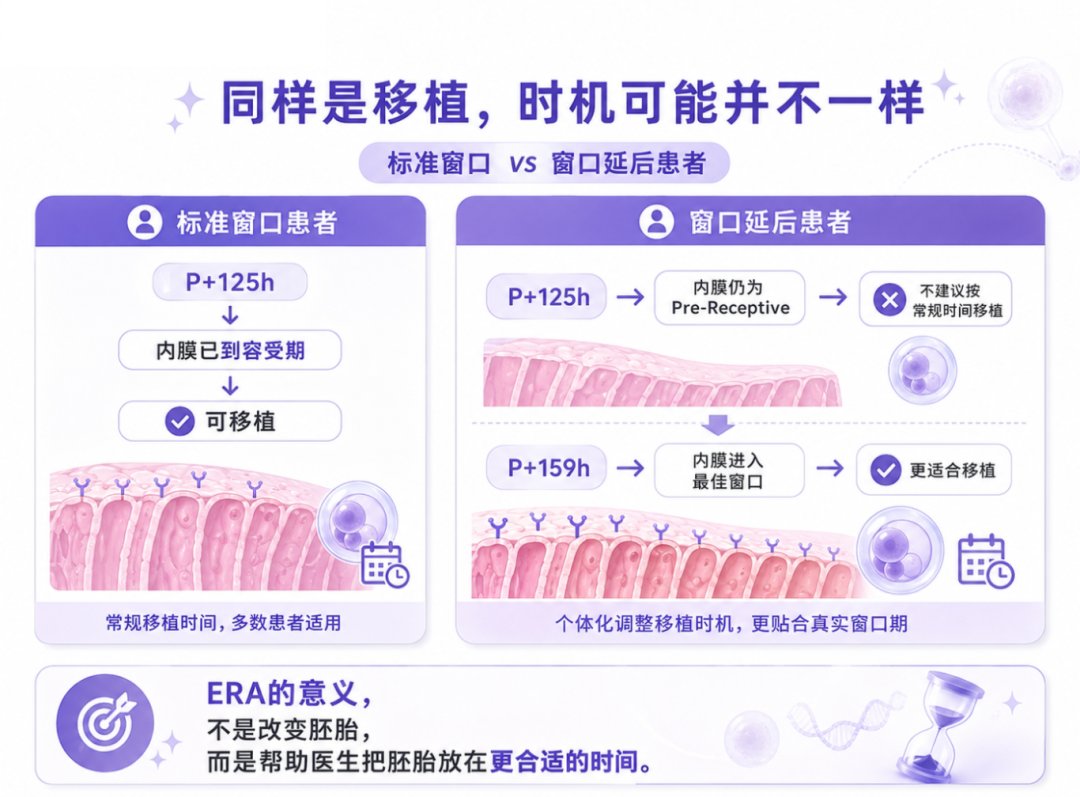 不是所有人的种植窗口都一样:ERA 如何帮助实现个体化胚胎移植